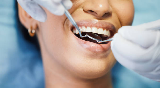 Best Urgent Care for Lost Fillings or Crowns in Roan Mountain, TN