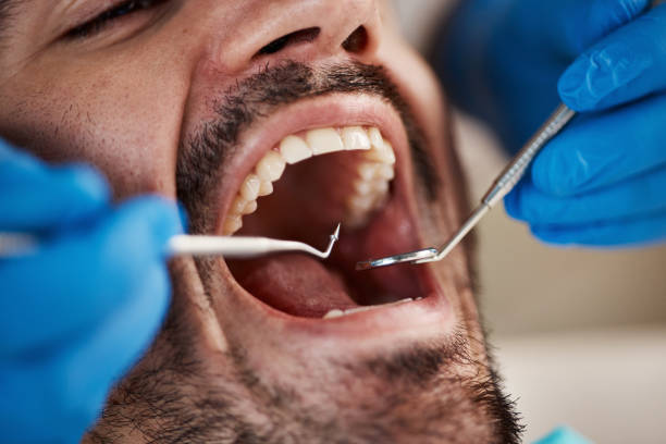 Best Pediatric Emergency Dentist in Roan Mountain, TN
